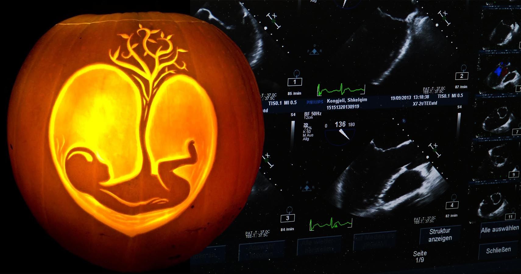 Couple Announces Pregnancy With Ultrasound Carved Into Pumpkin